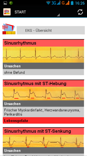 EKG-Monitoring Screenshot 2