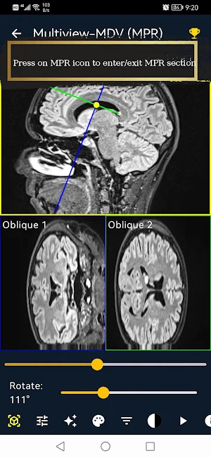 MDV - Medical Dicom Viewer Screenshot 2