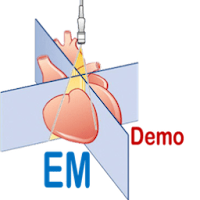 EM Demo: Echo Basics