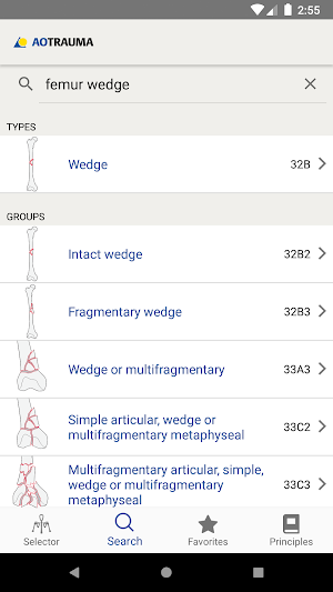 AO/OTA Fracture Classification Screenshot 2