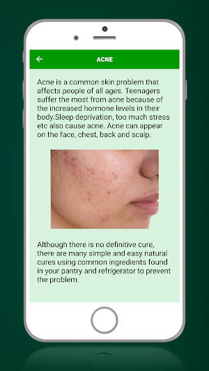 Aloe Vera Benefits : Aloe Vera Uses Screenshot 3