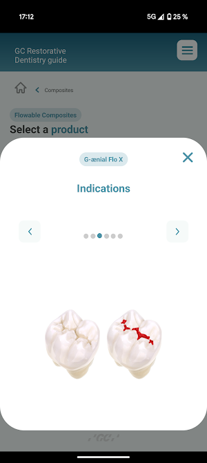 GC Restorative Dentistry Screenshot 3