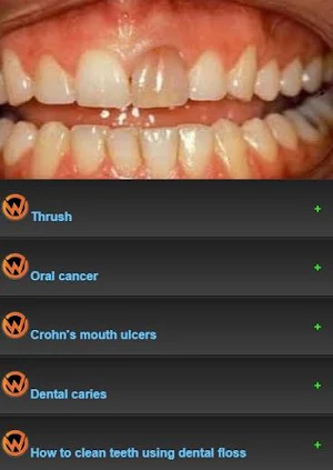 All dental diseases Screenshot 3