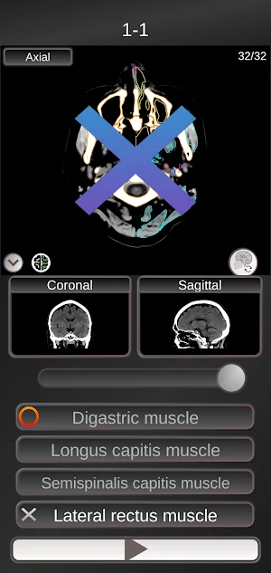 CT PassQuiz Head/Brain / sectional anatomy / MRI Screenshot 1