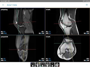 IMAIOS Dicom Viewer Screenshot 3