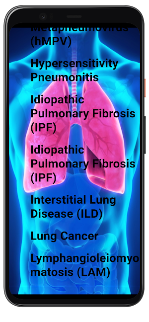 All Respiratory Diseases Guide Screenshot 2