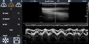 Youkey SonoiQ - Wireless Pocket Ultrasound System Screenshot 2