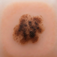 Holey Mole - Scan and Track