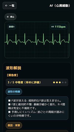 モニター心電図トレーニング Screenshot 3