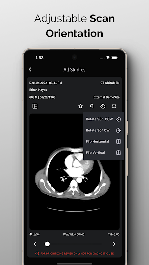 NeuroView Screenshot 2