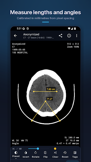 DicomLens – DICOM Viewer Screenshot 2