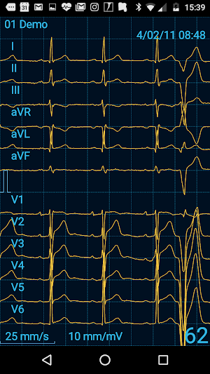 CardioFlex ECG Screenshot 3