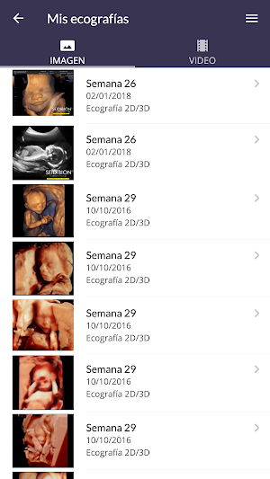 OBS VILA Screenshot 1