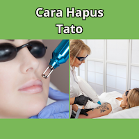Cara Hapus Tato
