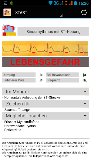 EKG-Monitoring Screenshot 3