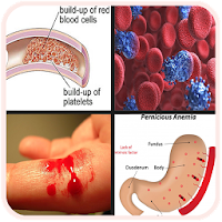All Blood Disease and Treatment A-Z