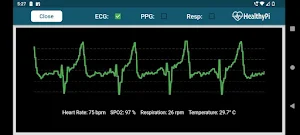 HealthyPi Screenshot 1