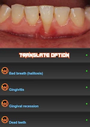 All dental diseases Screenshot 0