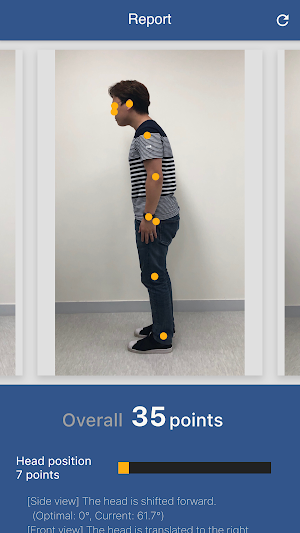 AI Posture Analysis Screenshot 2