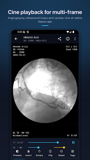 DicomLens – DICOM Viewer Screenshot 3