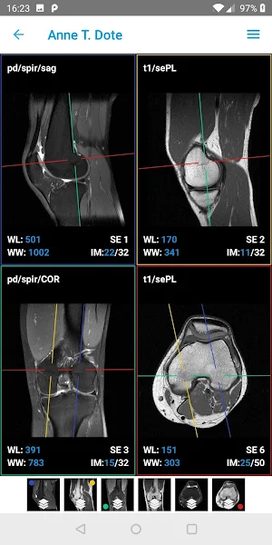 IMAIOS Dicom Viewer Screenshot 1