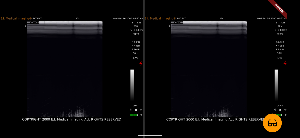 EVOStream Screenshot 3
