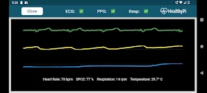 HealthyPi Screenshot 0