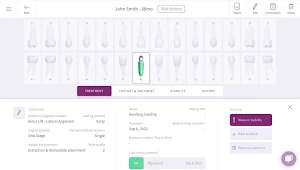 OsstellConnect Screenshot 2