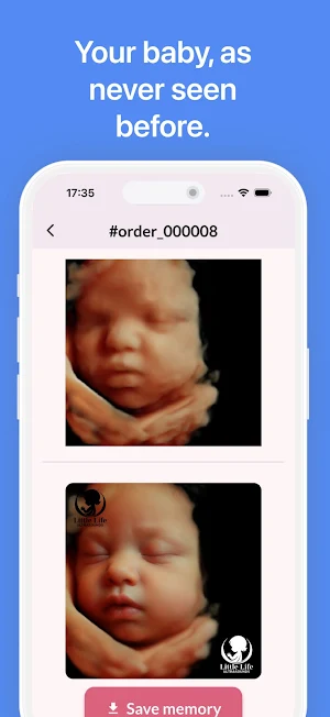LittleLife 3D 4D Ultrasound 8K Screenshot 1