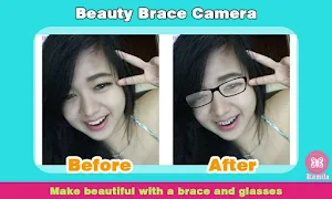 Beauty Brace Camera Screenshot 3