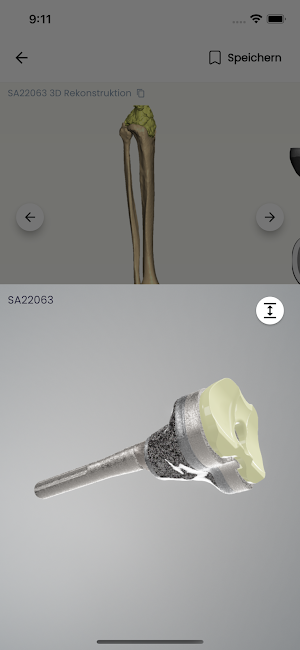 implantcast C-Fit 3D® Screenshot 3