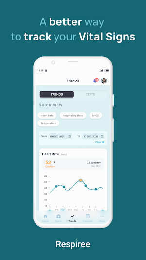 Respiree Singapore Screenshot 1