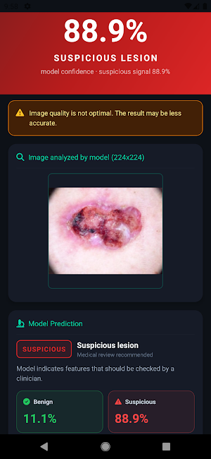 Skin Scanner AI: Mole Check Screenshot 3