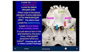 Head & Neck Anatomy-SecondLook Screenshot 1