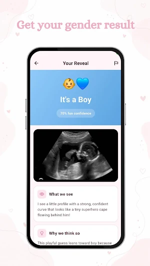 Baby Gender Scanner AI: Bobo Screenshot 2