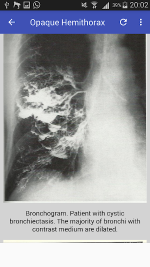 Clinical Chest Radiology Screenshot 3