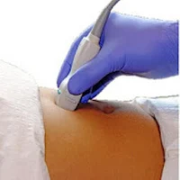 Ultrasound cases +
