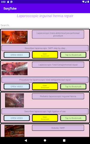 SurgTube Screenshot 3