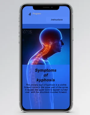 kyphosis exercise rounded back Screenshot 3